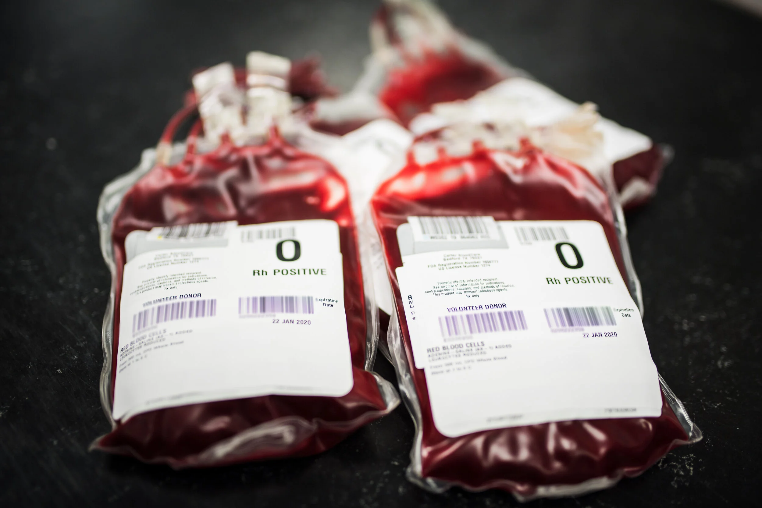 Red Cell Exchange and Sickle Cell Disease