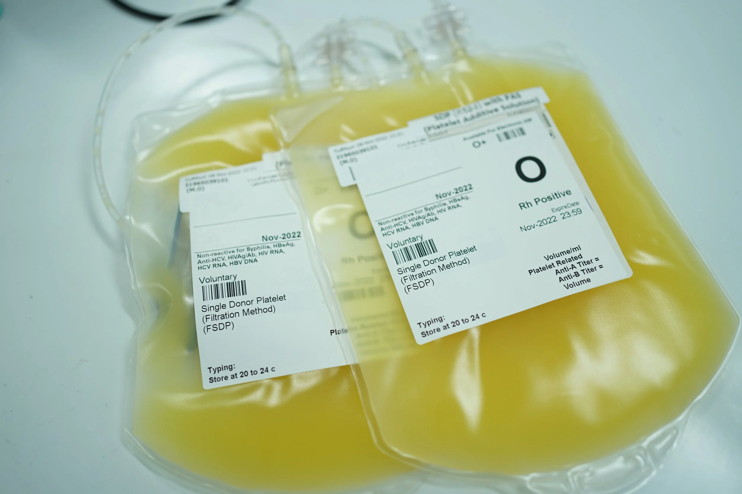 Platelet Needs for Antiplatelet Therapy in Patients with Spontaneous Interacerebral hemorrhage - AABB PBM Column Newsletter