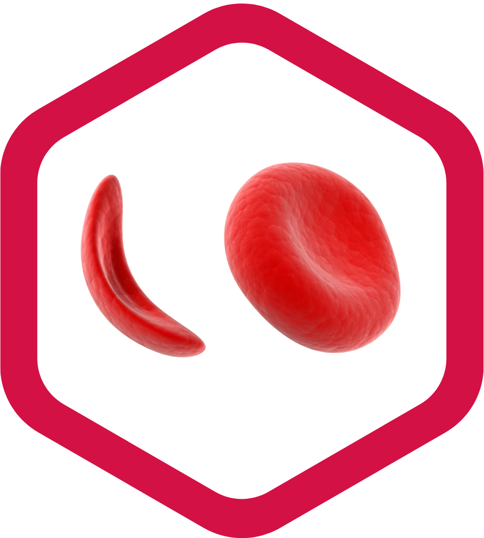 First Ever FDA-Approved Gene Therapies for Patients with Sickle Cell Disease: