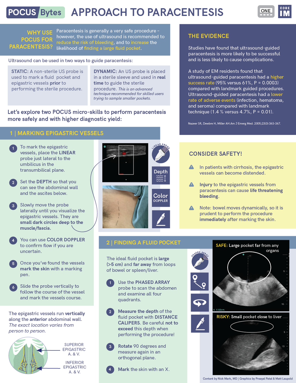 Ibd Pocus POCUS — ICU One Pager