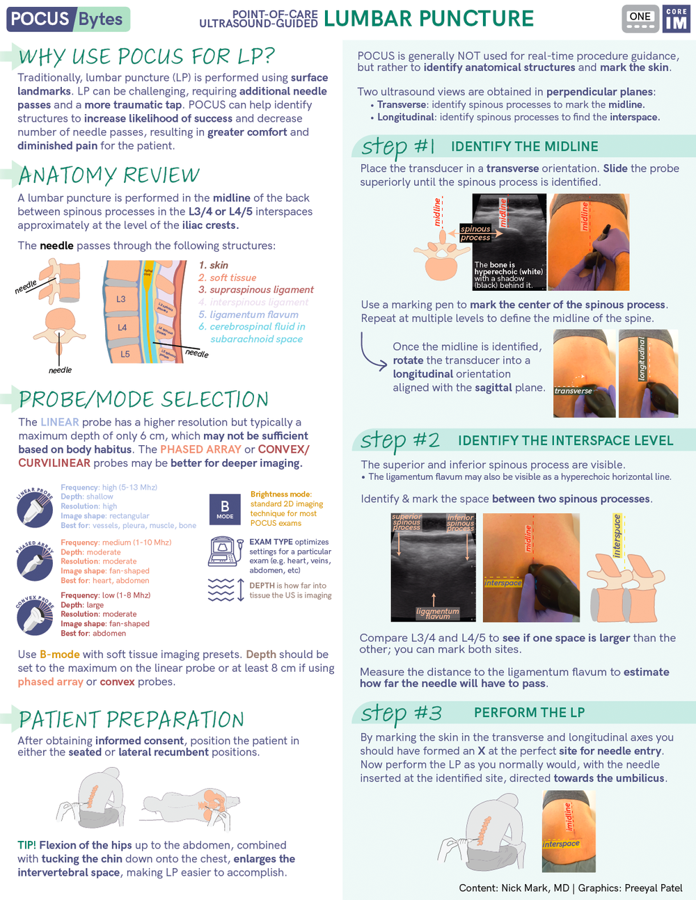 Lev Protocol Pocus POCUS — ICU One Pager