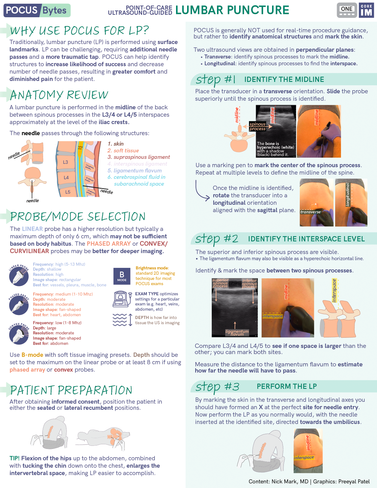 POCUS — ICU One Pager