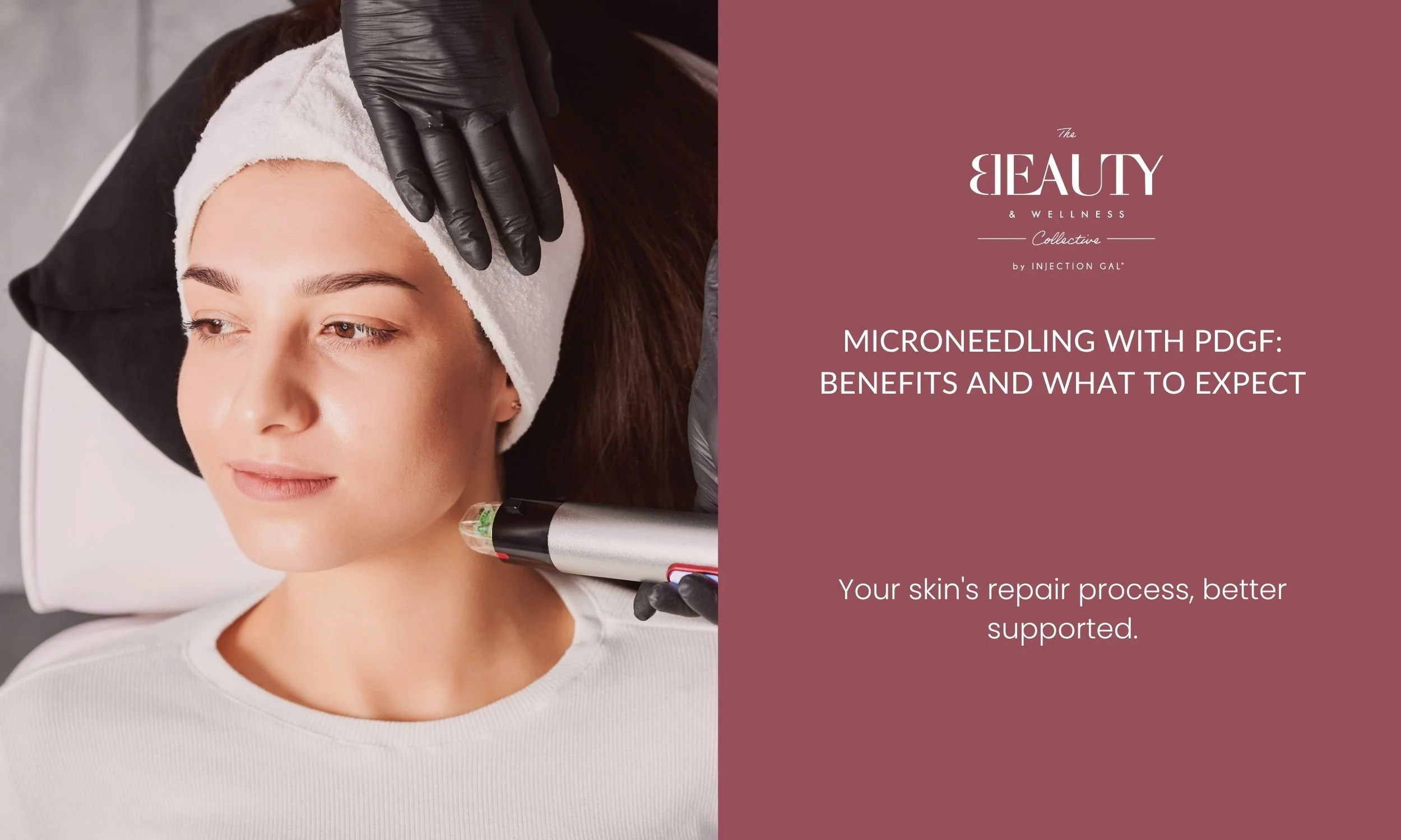 Microneedling With PDGF: Benefits and What to Expect