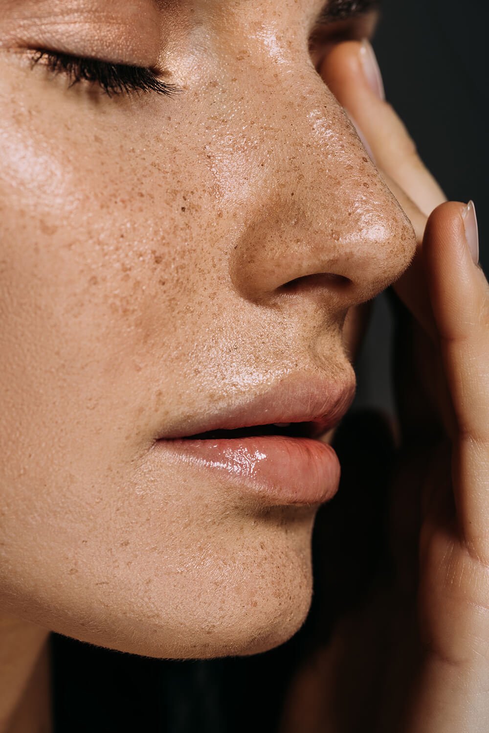 pigmented-lesions-treatment-Reno-Nevada-The-Beauty-Collective.jpg