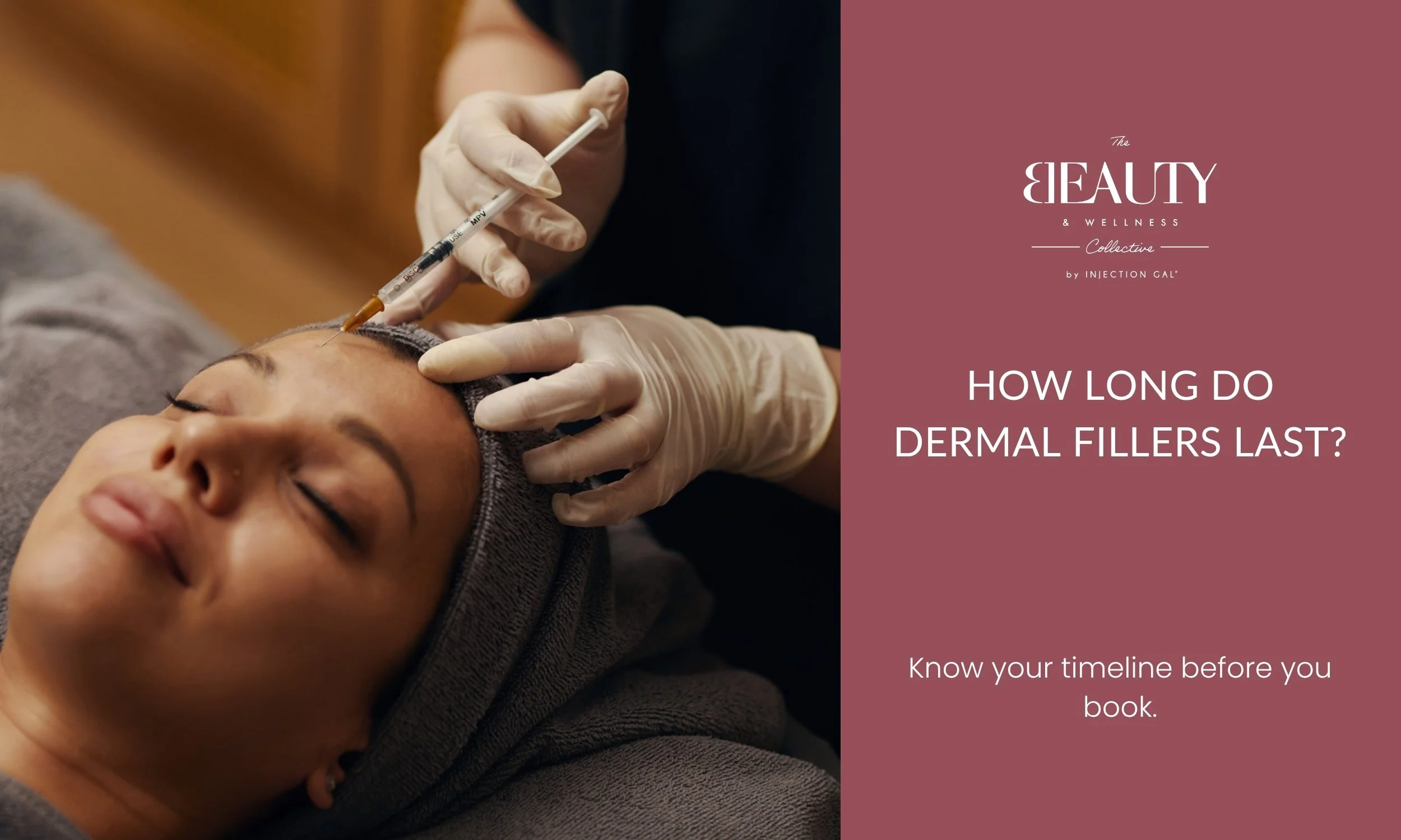 How Long Do Dermal Fillers Last?