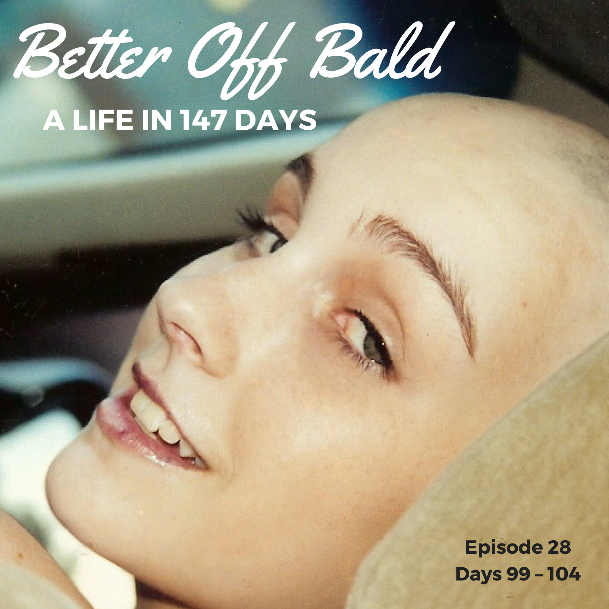 Better Off Bald: Episode 28 — Days 99 – 104