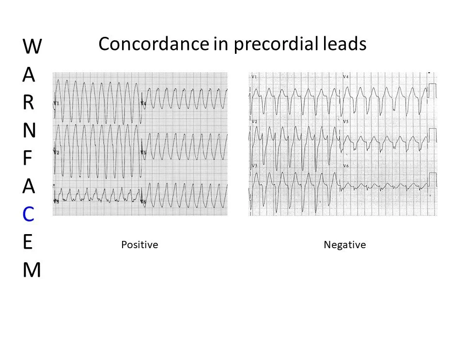 Slide8.JPG