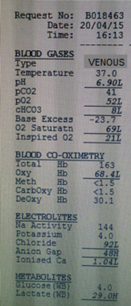 This is the blood gas example used in Alex and Mark’s talk