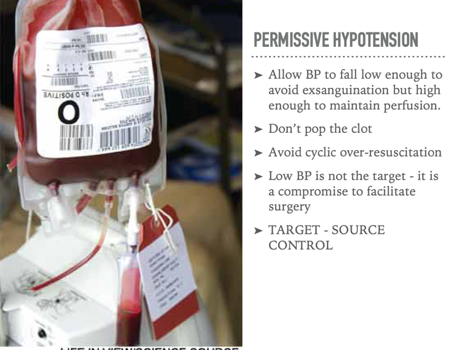 Slide11.png