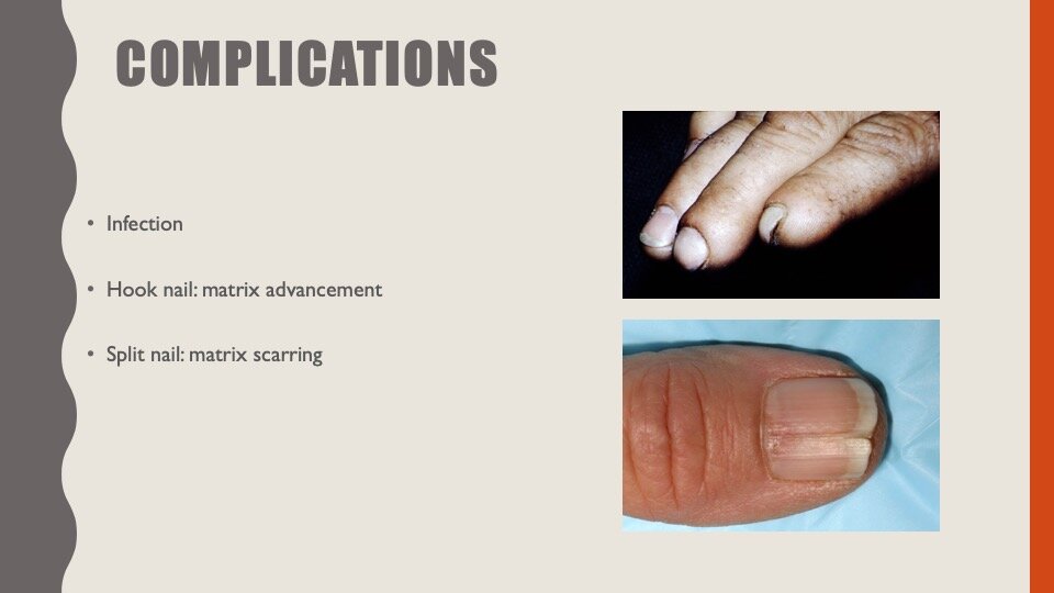 Slide13.jpeg
