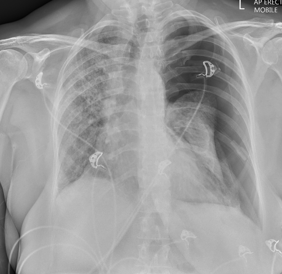 xray of the week.png