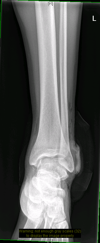 ankle.PNG
