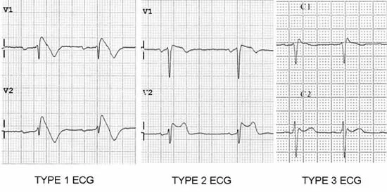 ej-vol7n25-fig1.jpg