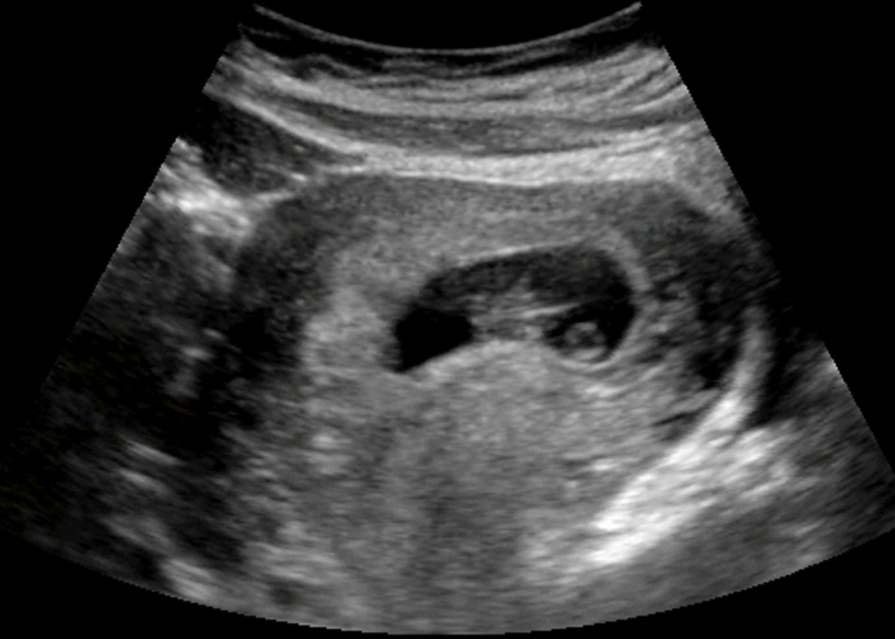 image 1.PNG