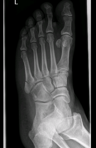 foot3.PNG