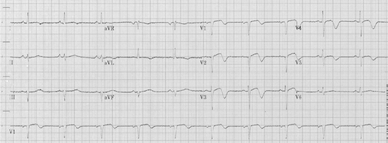 ECG 9.png