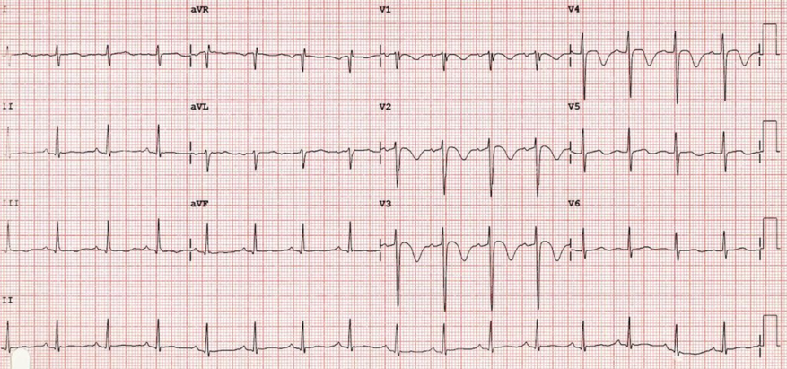 ECG 10.png