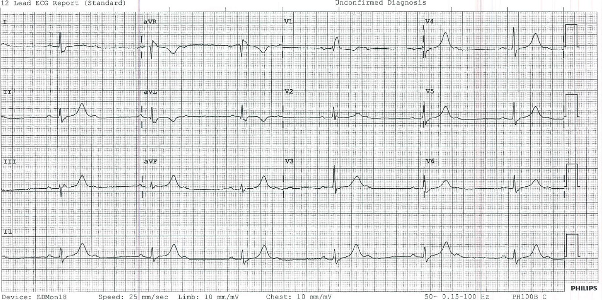 ECG of the week 7 oct.PNG
