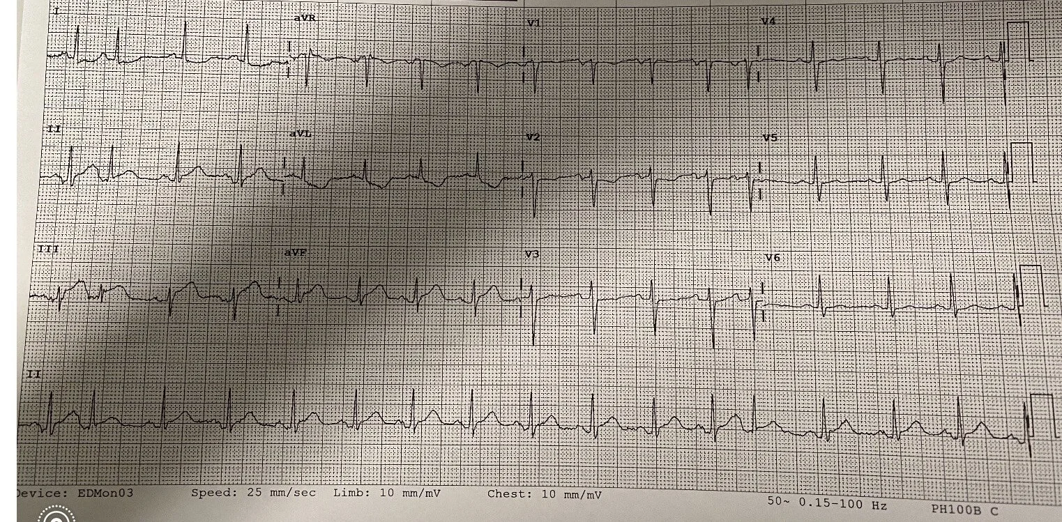 ECG of the week.jpeg
