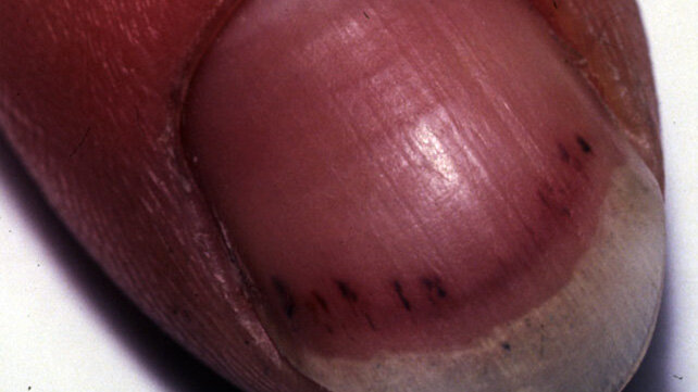 642x361_Black_Line_On_Nail_Pictures-SLIDE_3.jpg