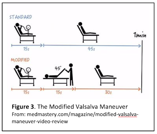 Standard and Modified Valsalva manouevres