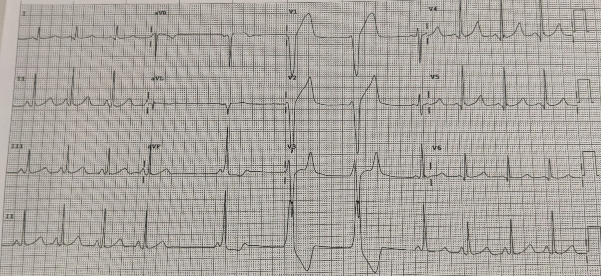 ECG.jpg