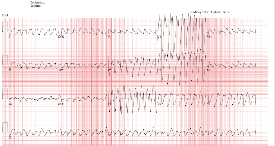 ecg1.png