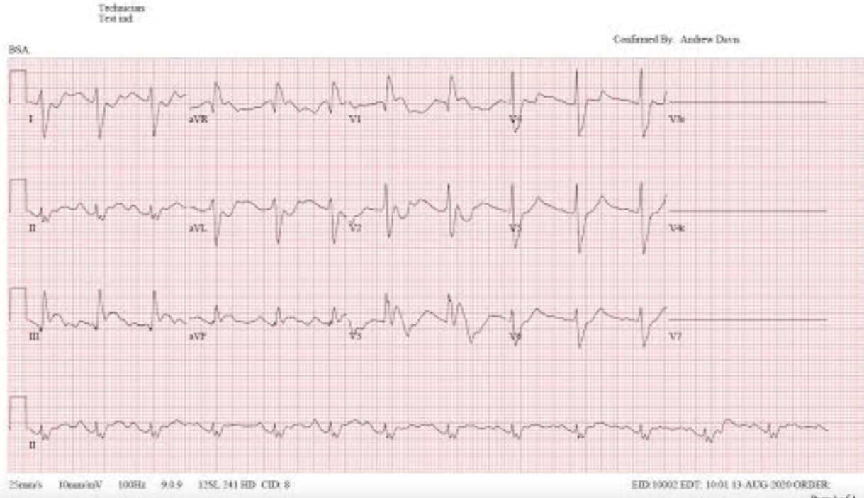 ecg2.png