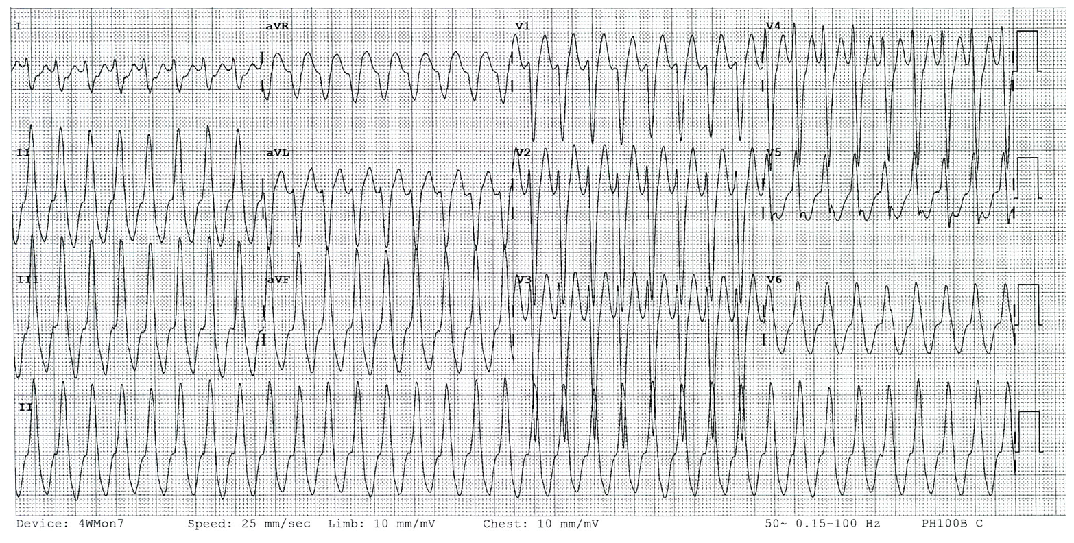 Capture.PNG