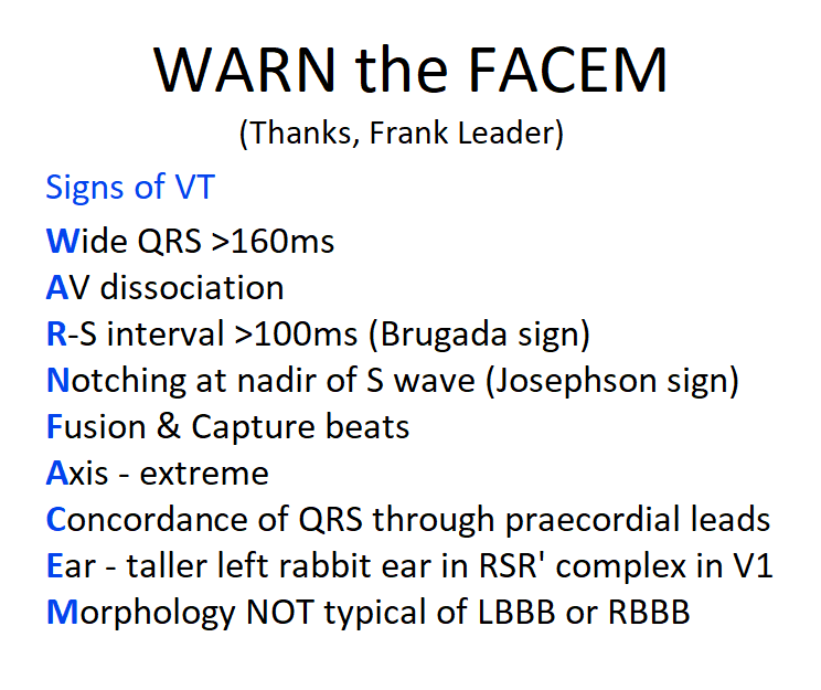 Signs of VT