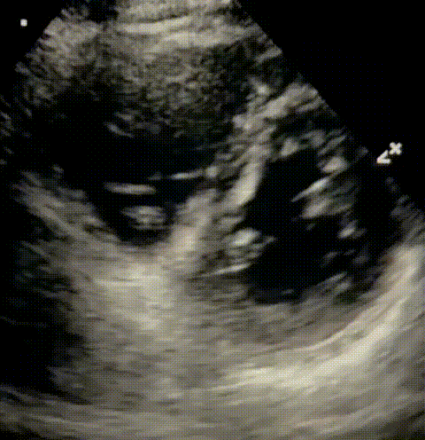 VID-20211016-WA0001.gif