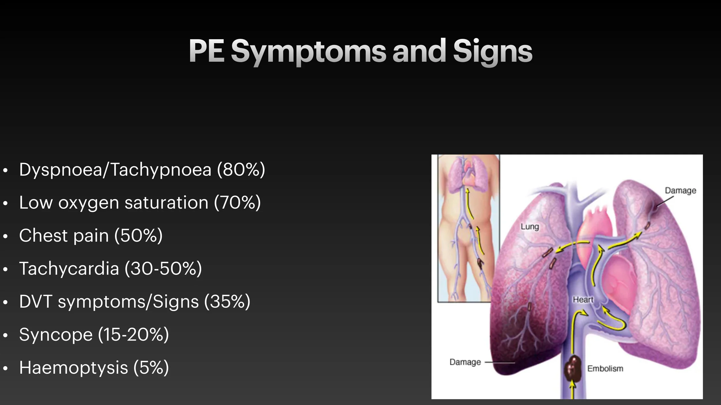 PE echo and ECG presentation-6.jpg