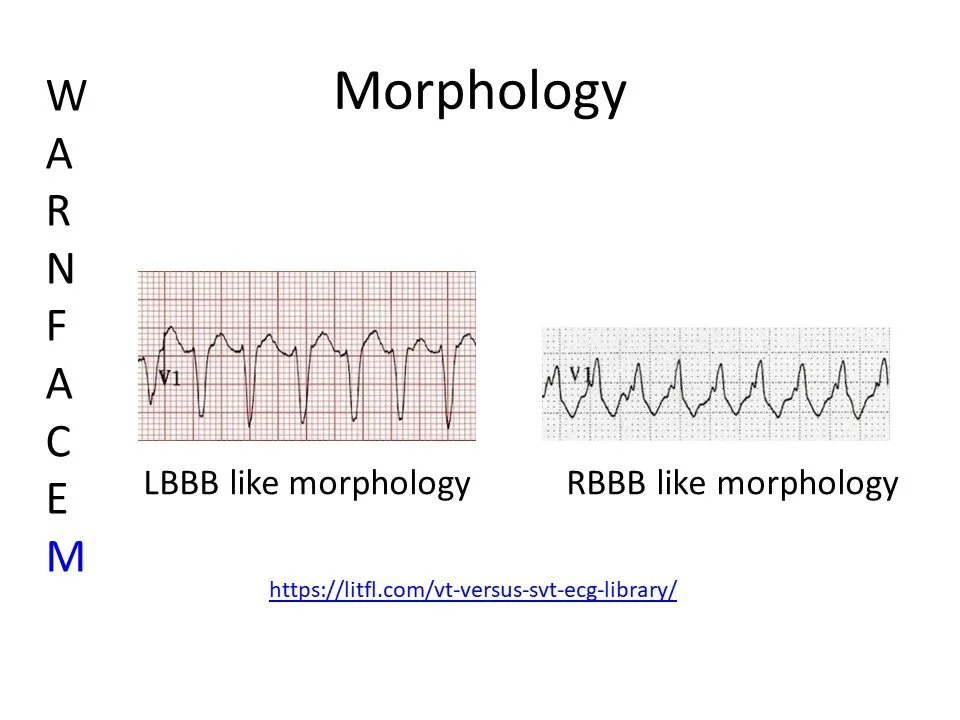 Slide10.JPG