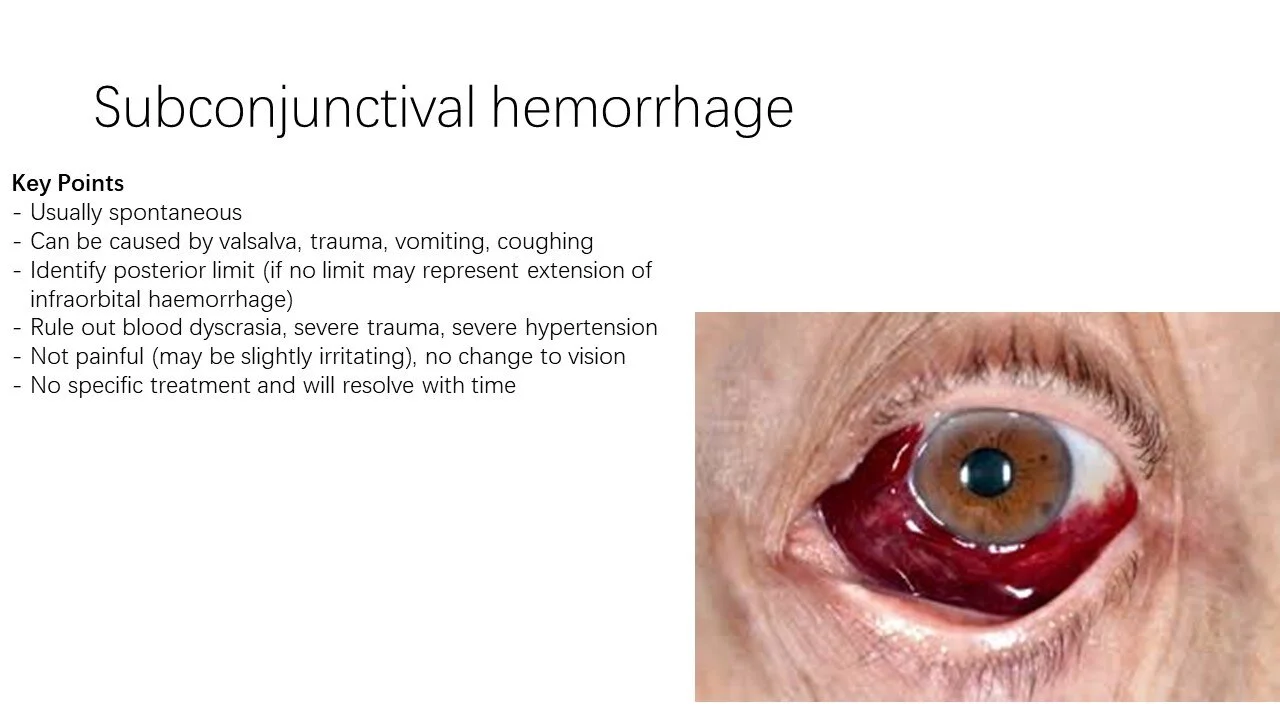 Slide13.JPG