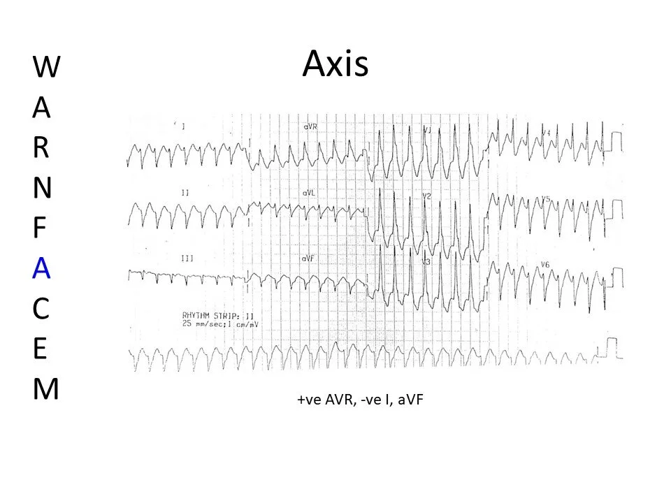 Slide7.JPG