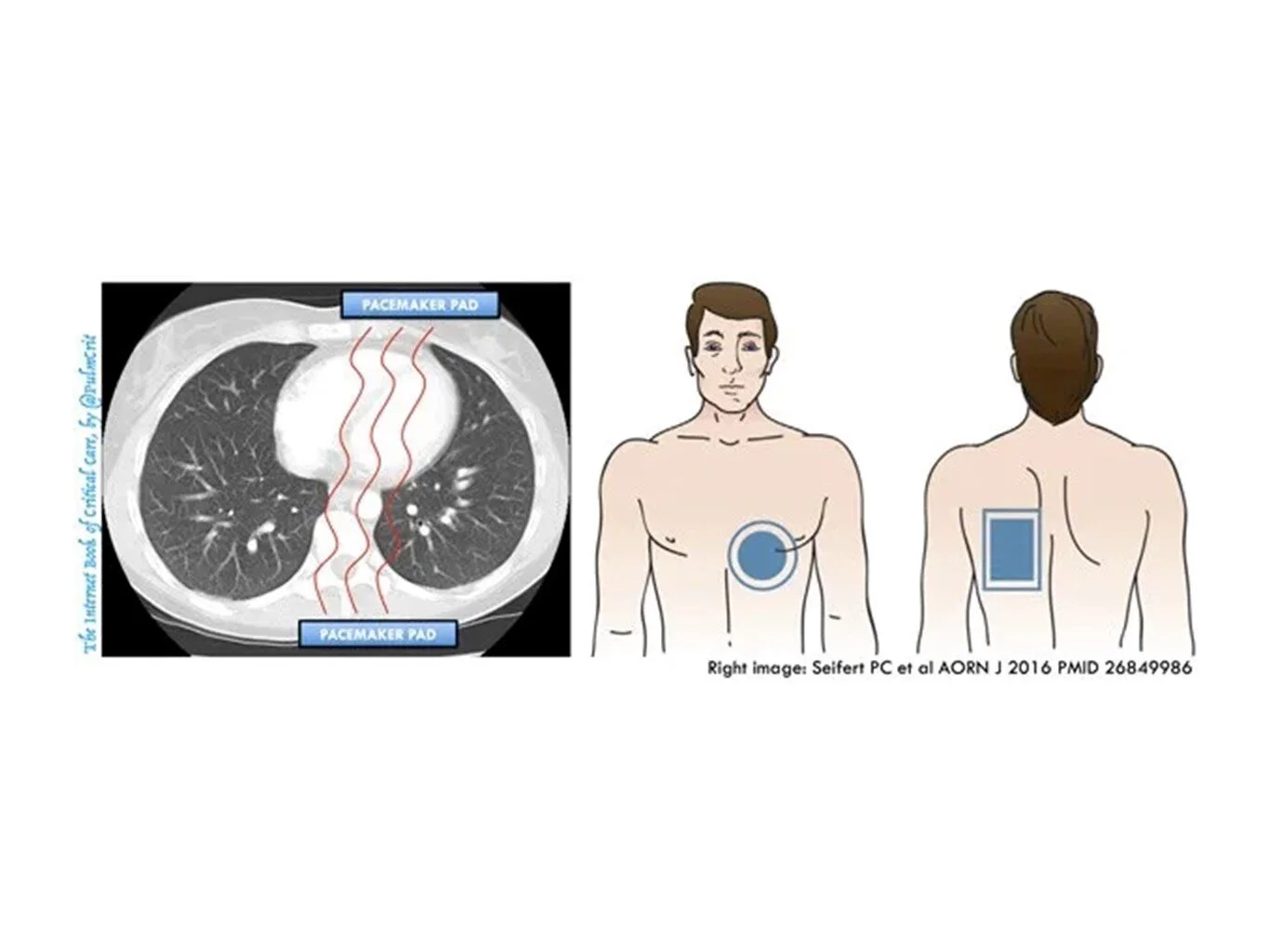 Slide14.JPG