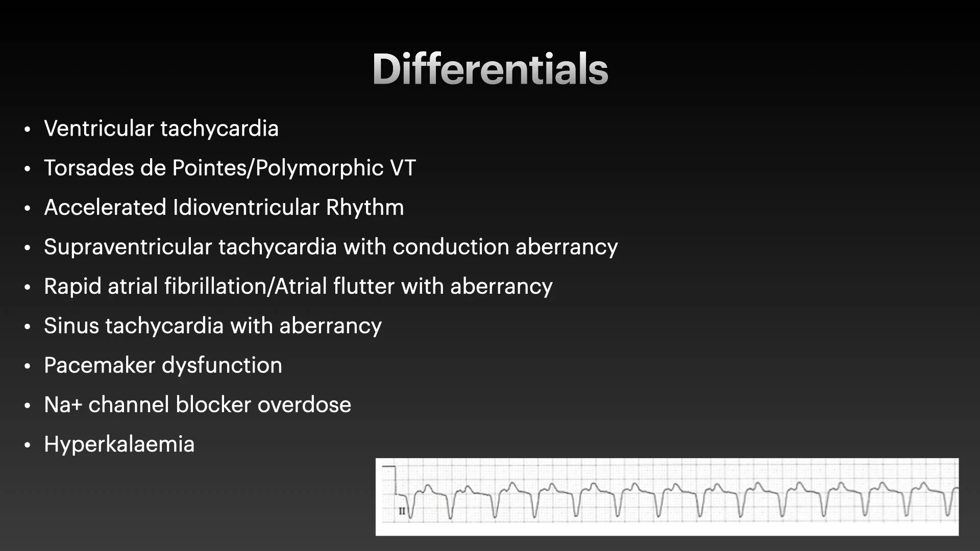 Broad Complex tachyarrhythmias.003.jpg