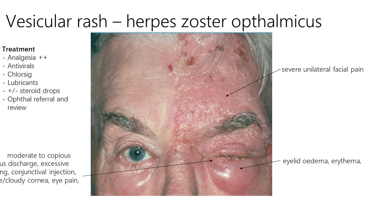 Slide12.JPG