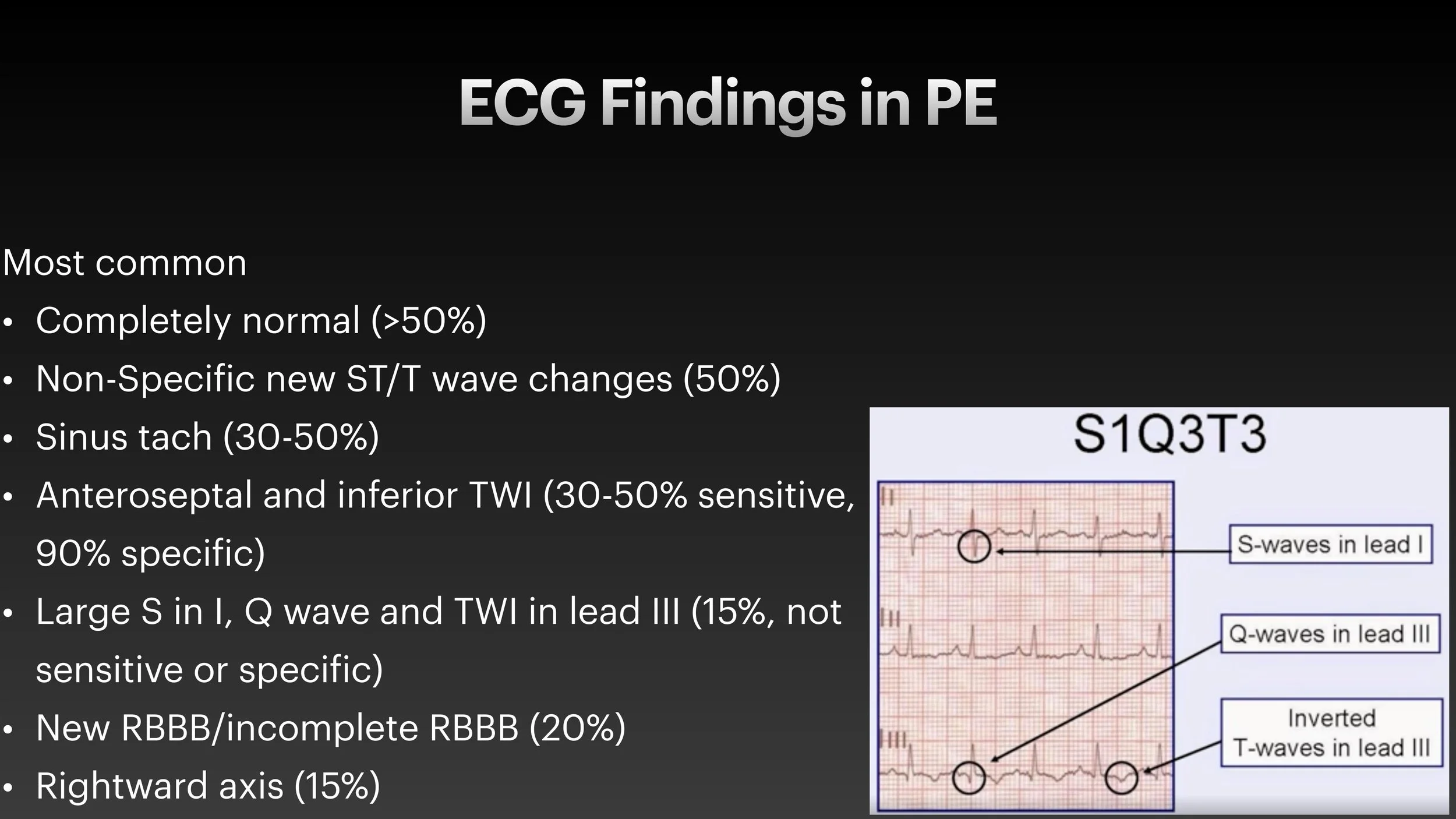 PE echo and ECG presentation-4.jpg