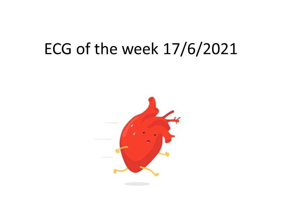 Slide1.JPG