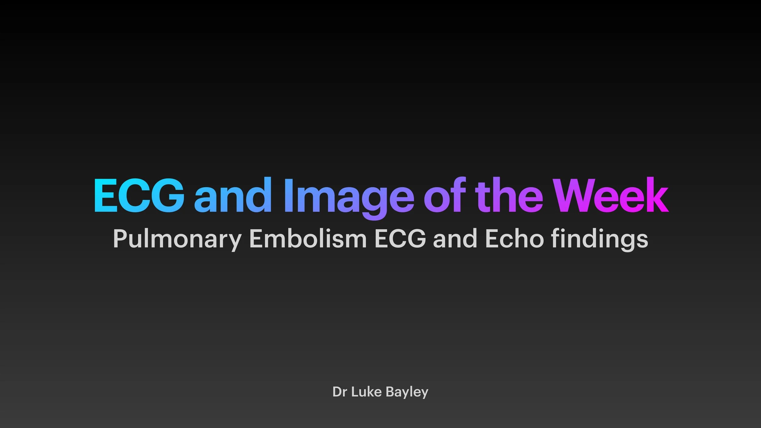 PE echo and ECG presentation-1.jpg