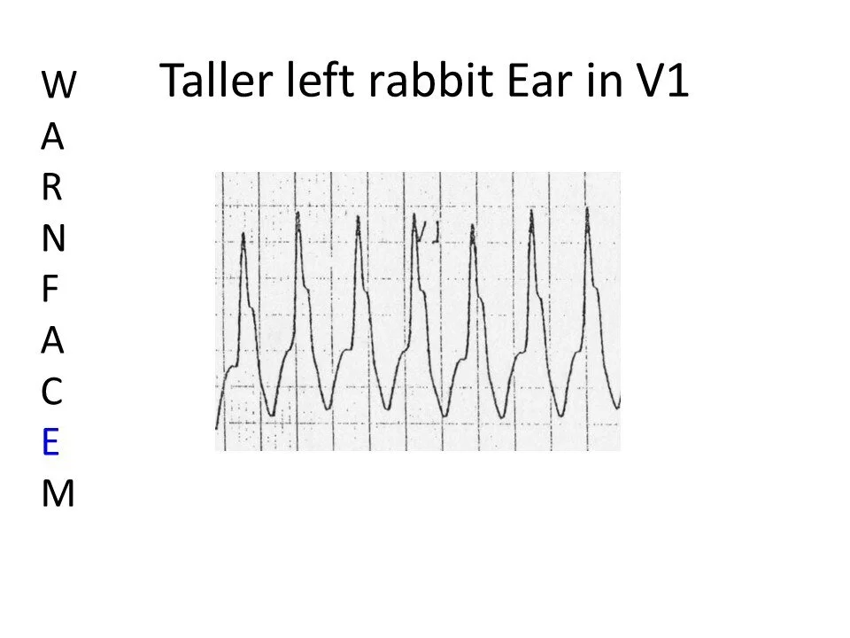 Slide9.JPG