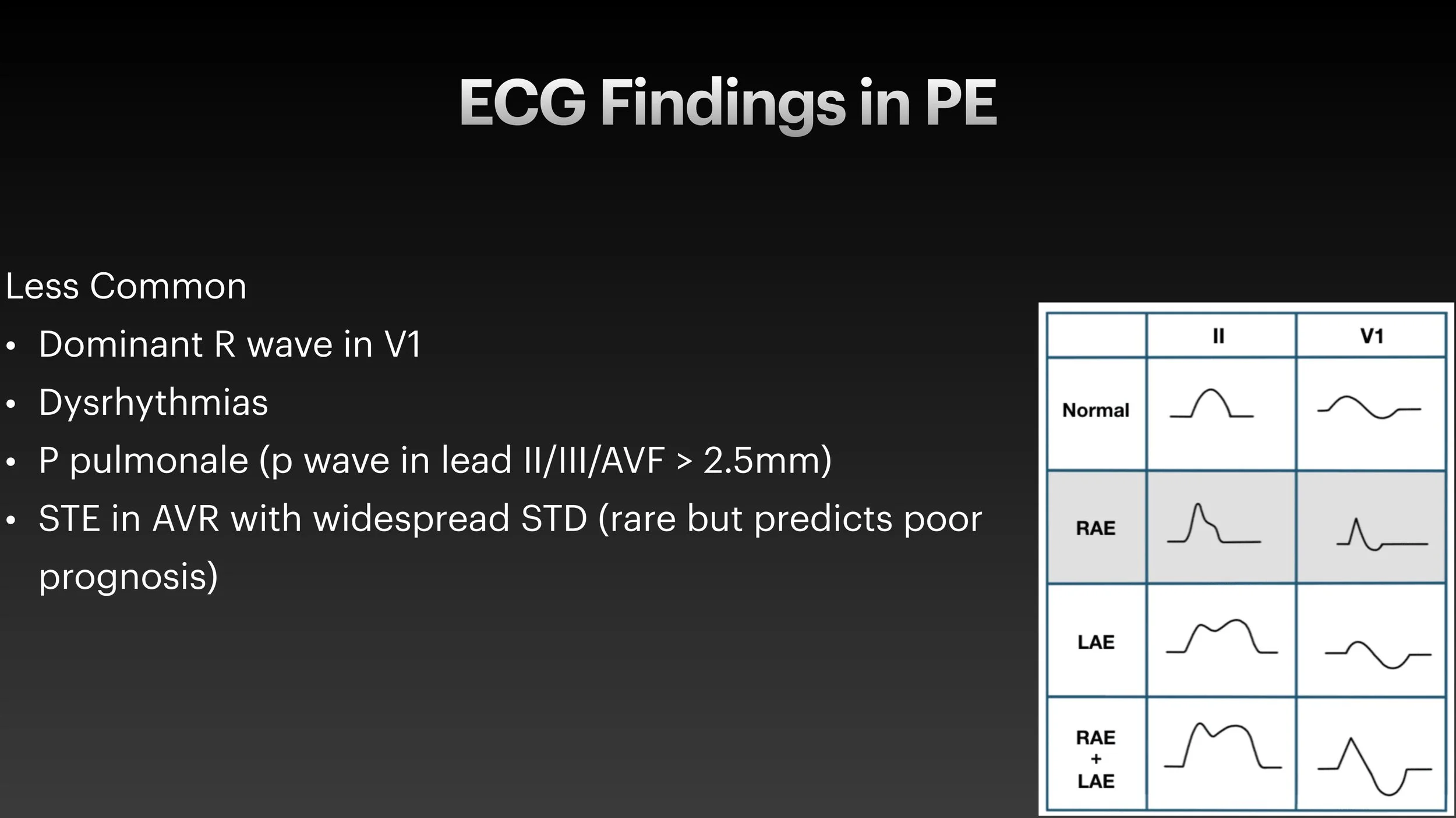 PE echo and ECG presentation-5.jpg