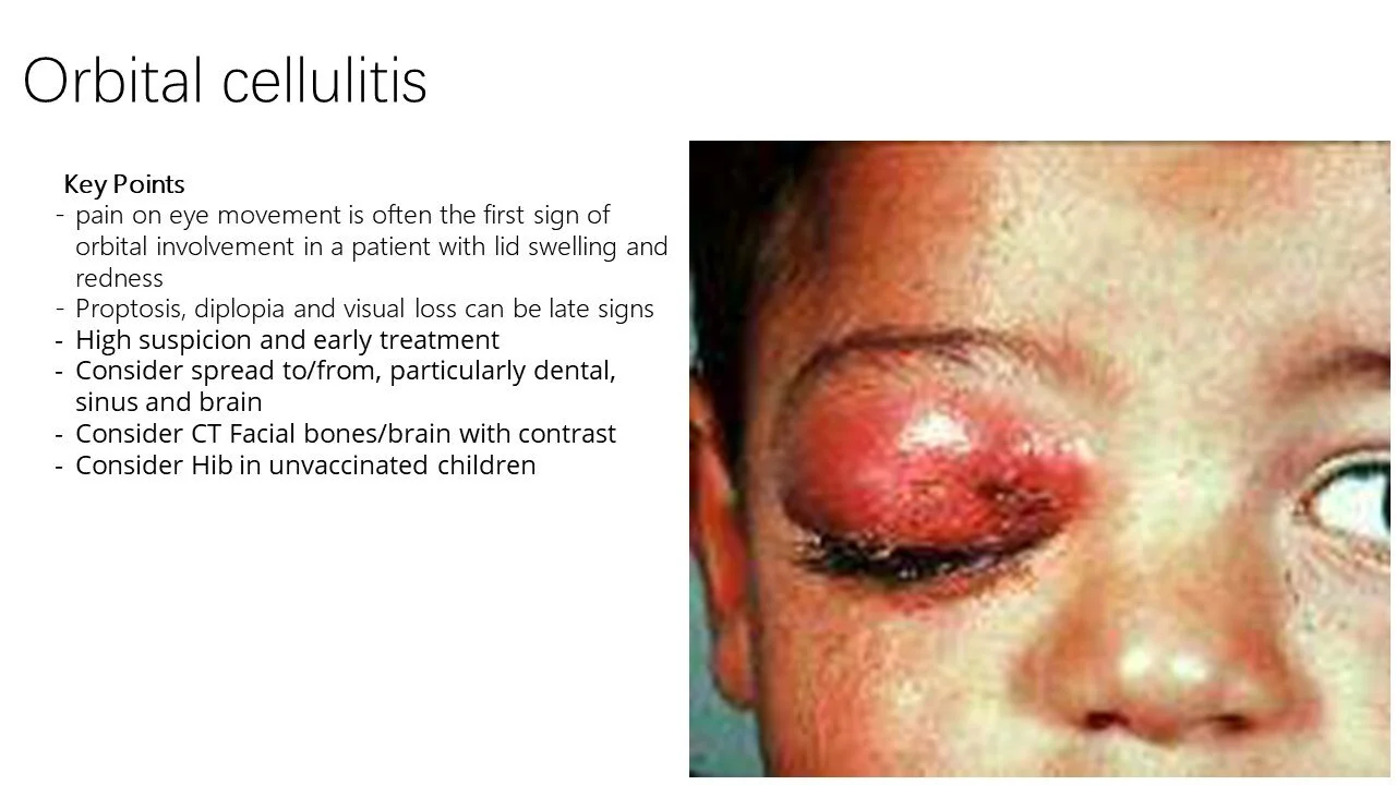 Slide14.JPG