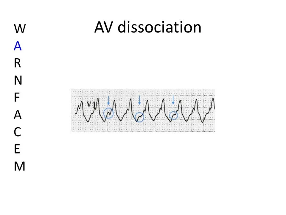 Slide4.JPG