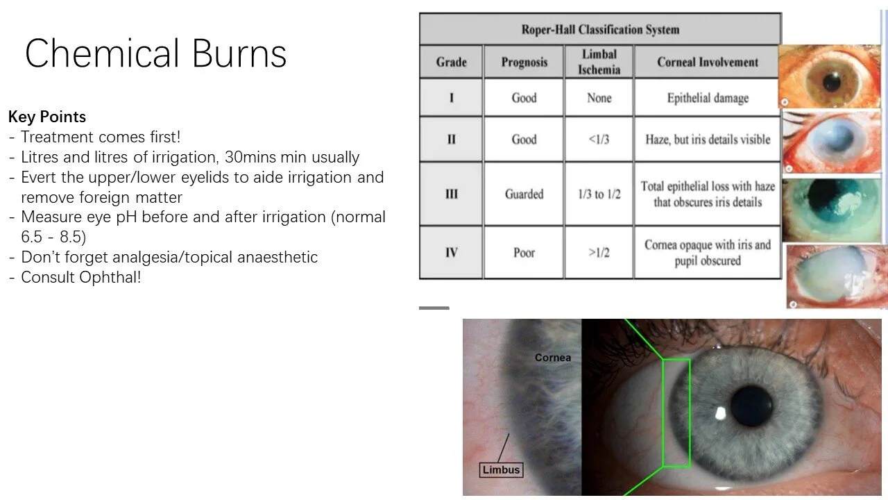 Slide17.JPG