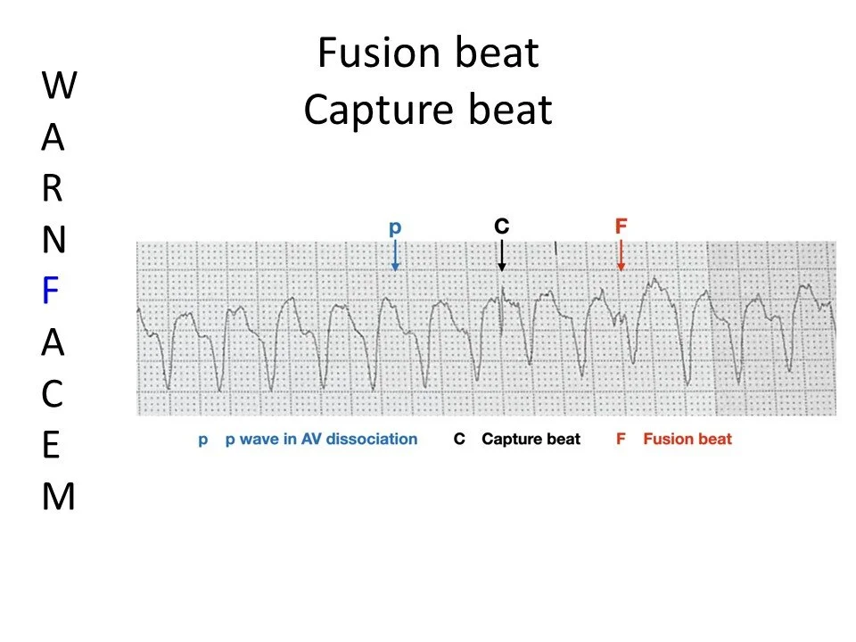Slide6.JPG