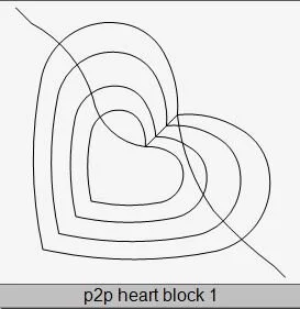 P2P Heart Block 1.JPG