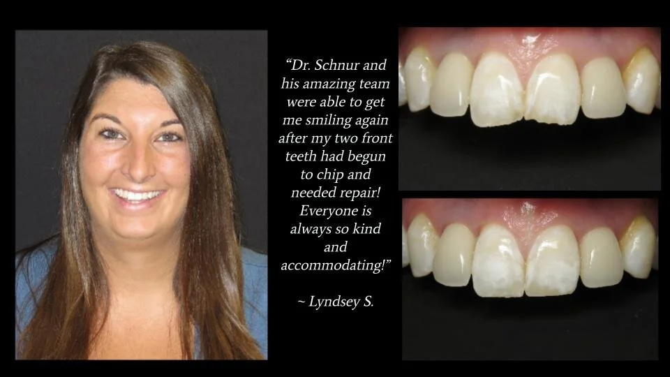 Smile Gallery — Florida Smile Design