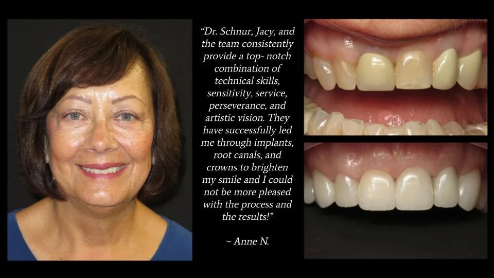 Smile Gallery — Florida Smile Design